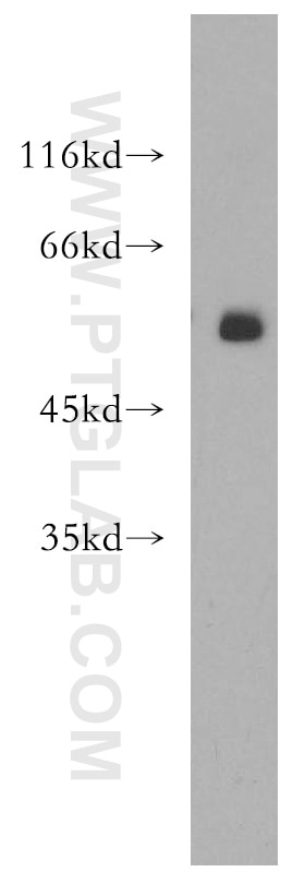 WB analysis of K-562 using 18285-1-AP