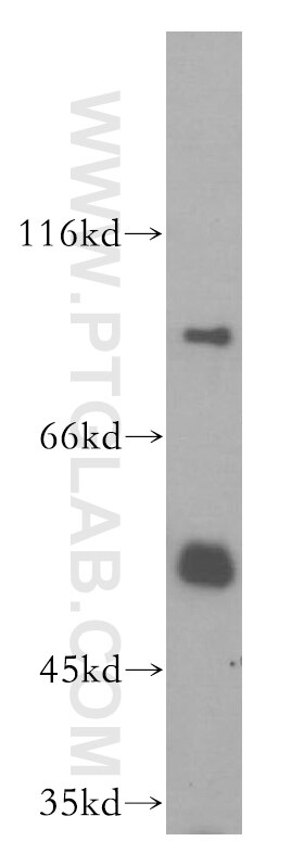 Western Blot (WB) analysis of HEK-293 cells using DDX19B Polyclonal antibody (18285-1-AP)