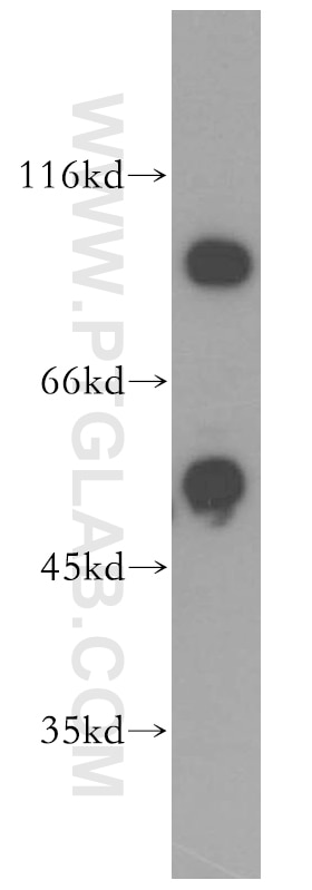 Western Blot (WB) analysis of HeLa cells using DDX19B Polyclonal antibody (18285-1-AP)