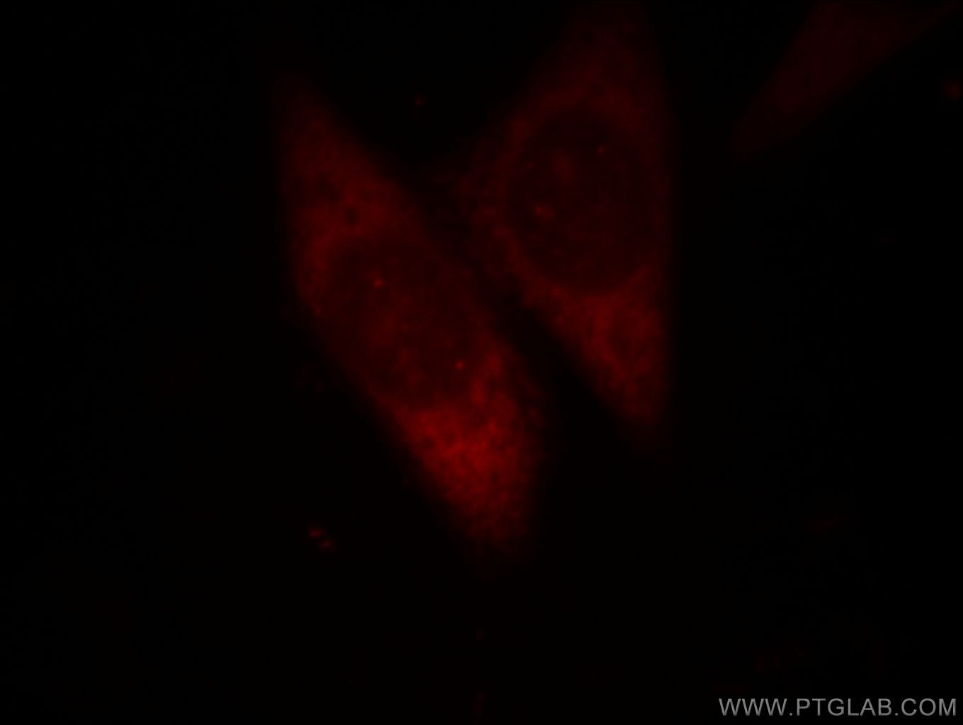 Immunofluorescence (IF) / fluorescent staining of HeLa cells using DDX20 Polyclonal antibody (11324-1-AP)