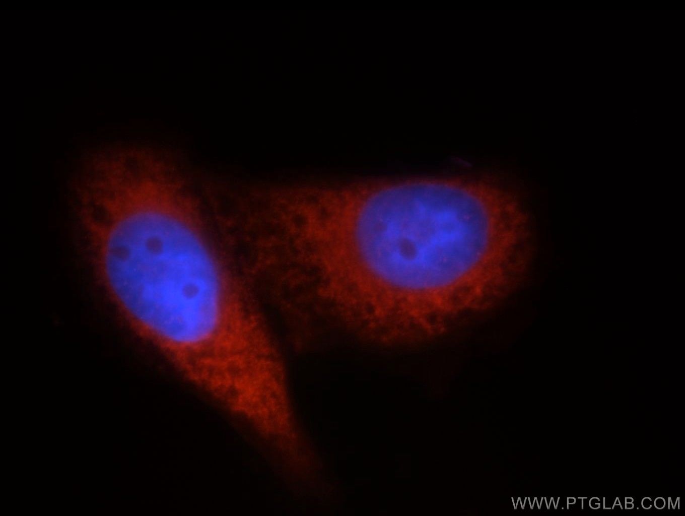 Immunofluorescence (IF) / fluorescent staining of HepG2 cells using DDX20 Polyclonal antibody (11324-1-AP)
