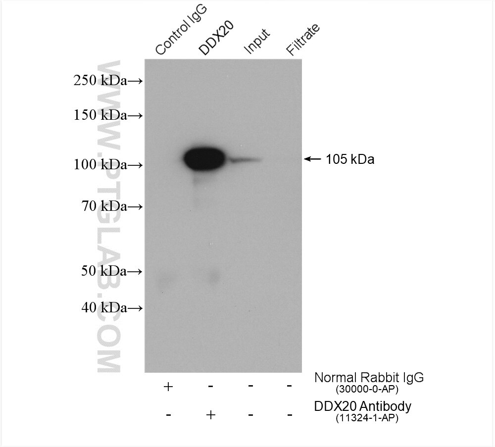 Immunoprecipitation (IP) experiment of HeLa cells using DDX20 Polyclonal antibody (11324-1-AP)