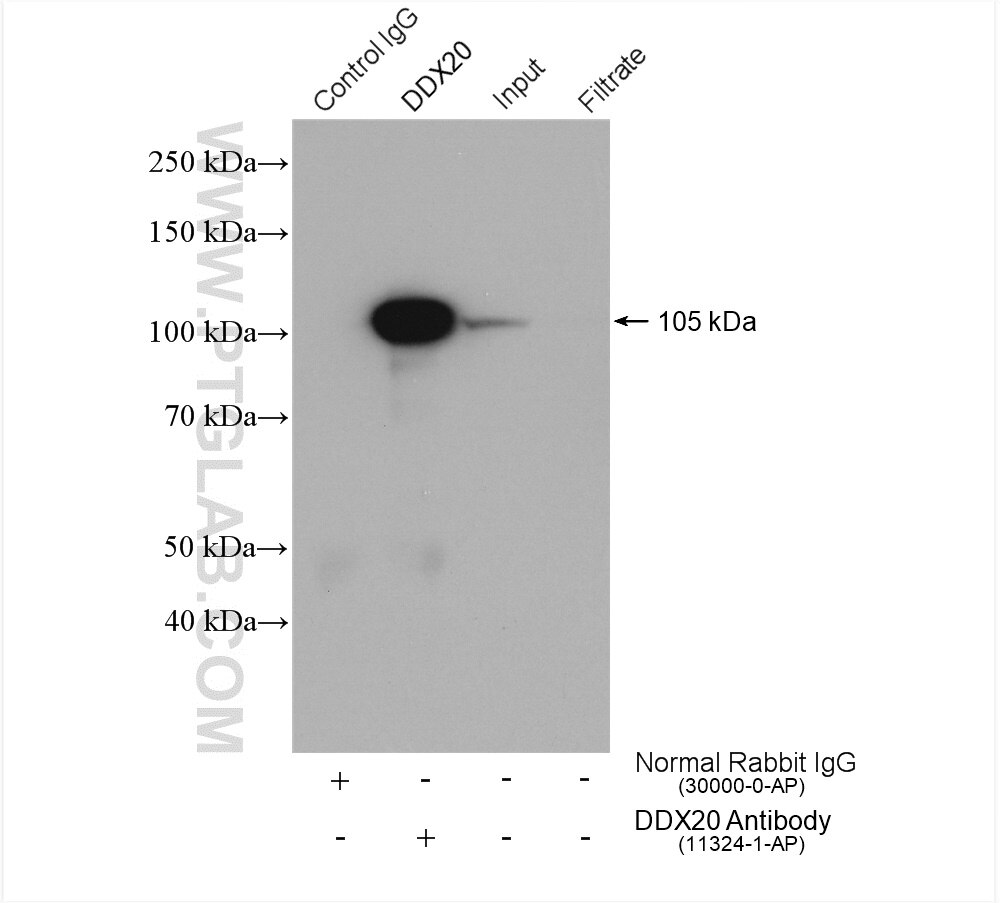 IP experiment of HeLa using 11324-1-AP