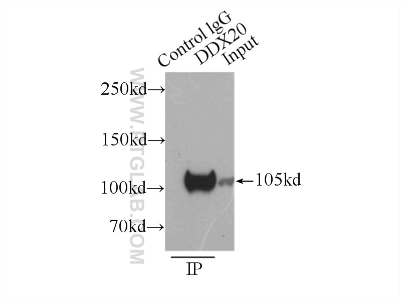 DDX20 Polyclonal antibody