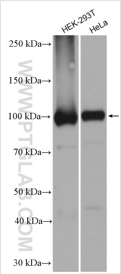 Western Blot (WB) analysis of various lysates using DDX20 Polyclonal antibody (11324-1-AP)