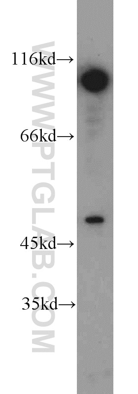 Western Blot (WB) analysis of Jurkat cells using DDX20 Polyclonal antibody (11324-1-AP)