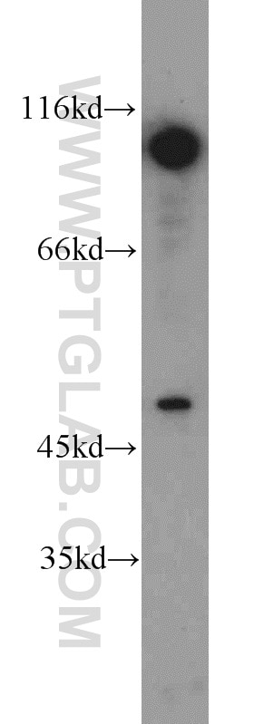 WB analysis of Jurkat using 11324-1-AP