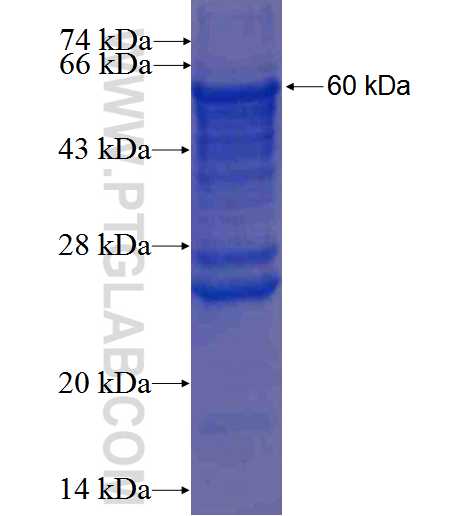 DDX20 fusion protein Ag1863 SDS-PAGE