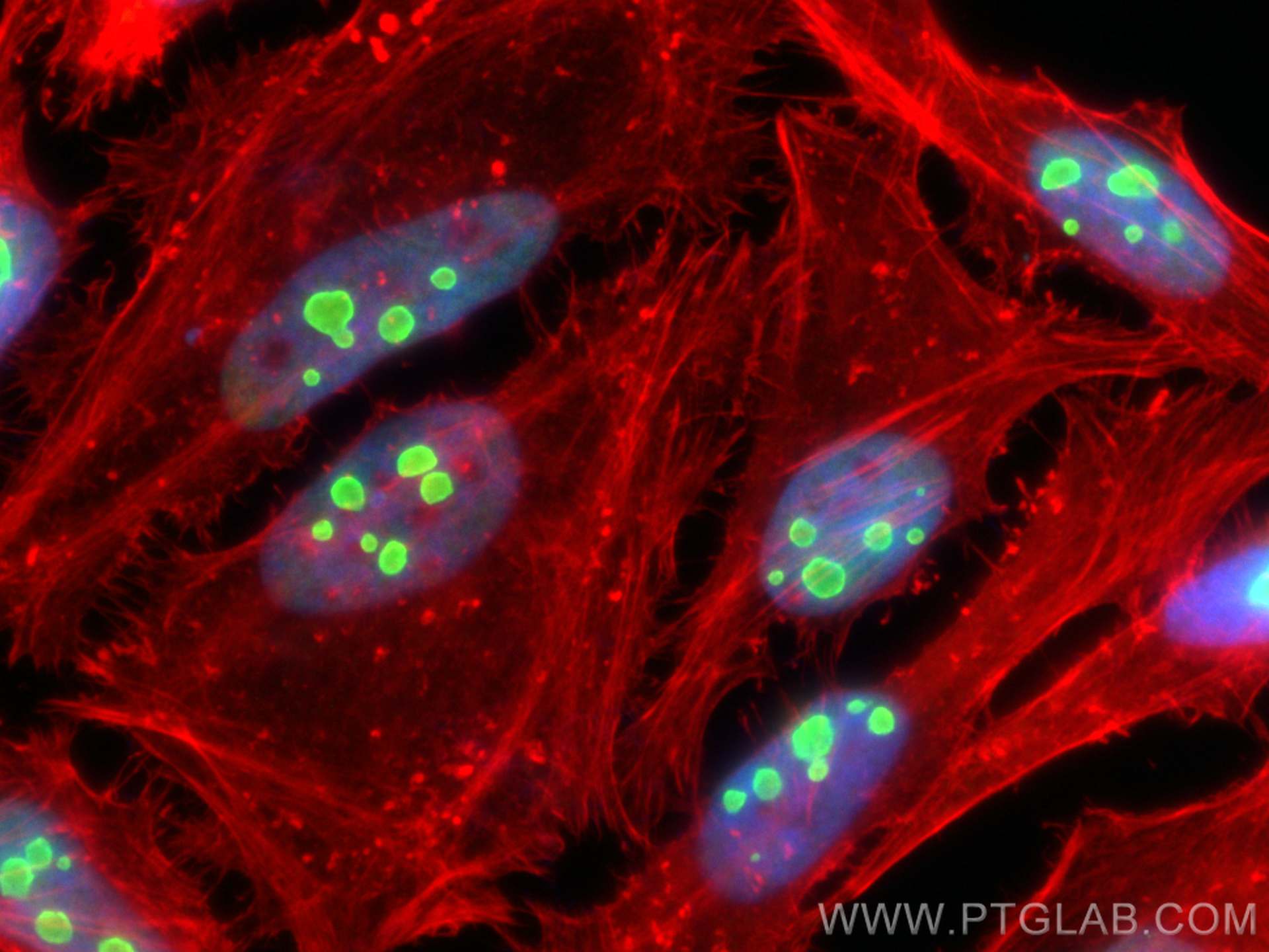 Immunofluorescence (IF) / fluorescent staining of HeLa cells using DDX21 Polyclonal antibody (10528-1-AP)