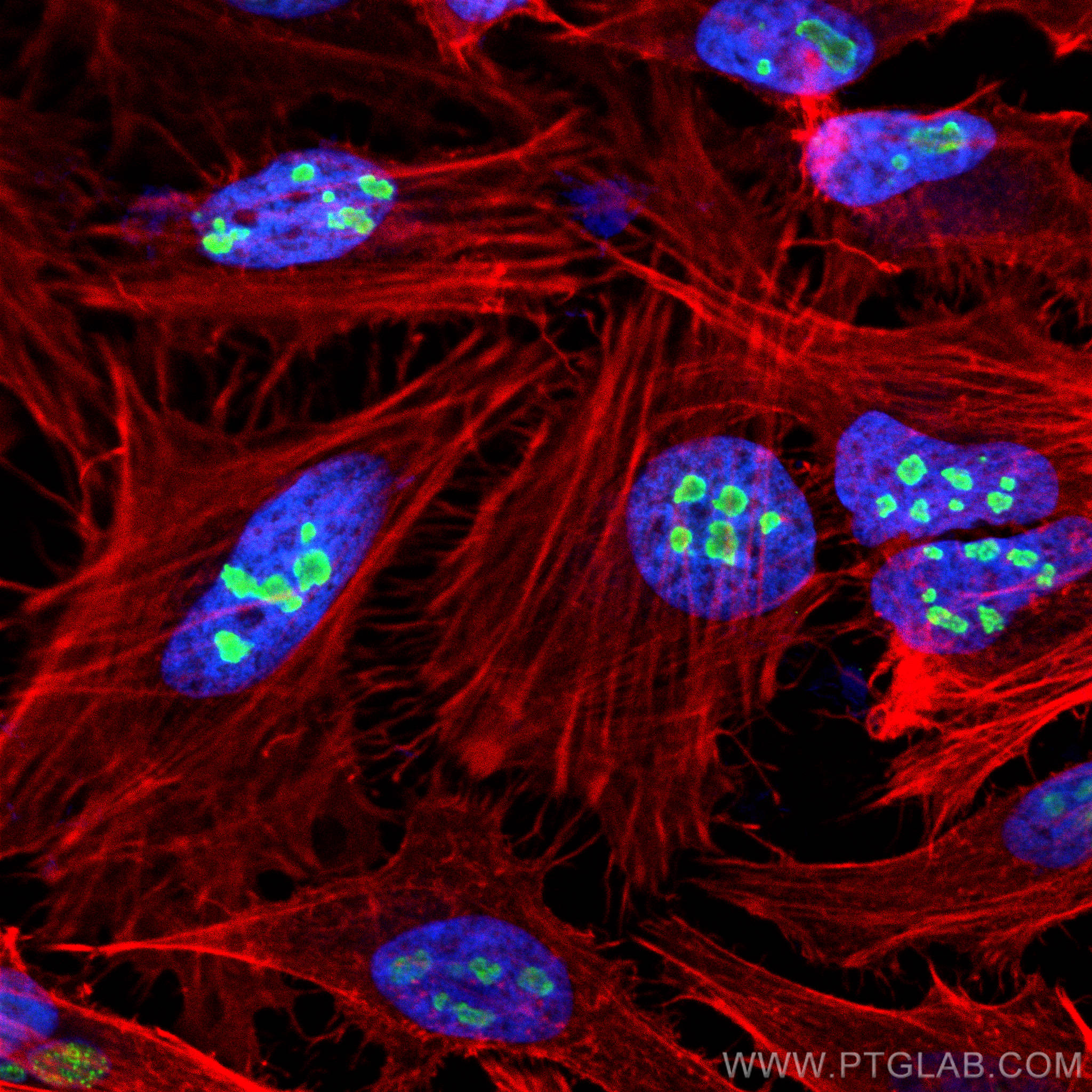 Immunofluorescence (IF) / fluorescent staining of HeLa cells using DDX21 Polyclonal antibody (10528-1-AP)