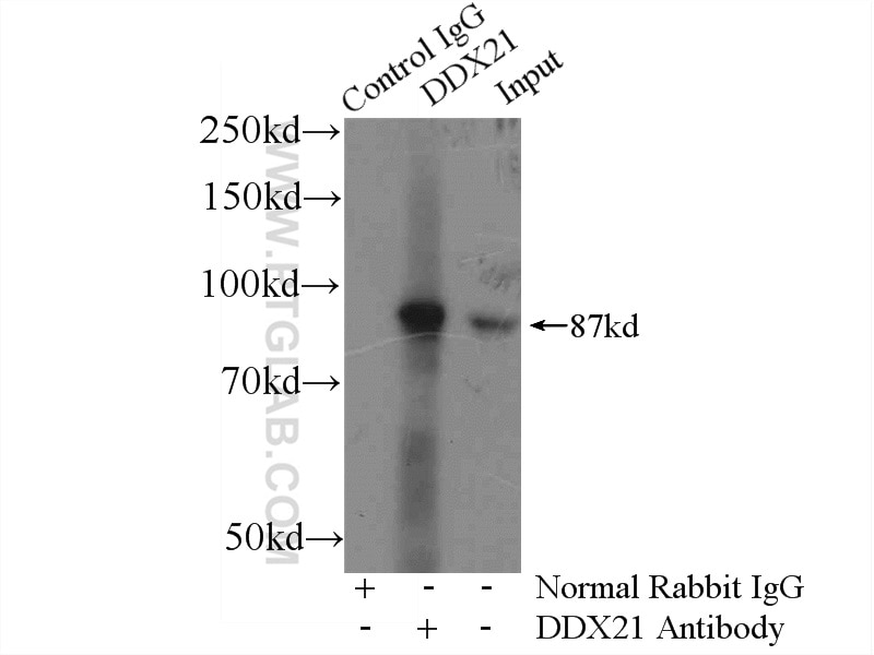 Immunoprecipitation (IP) experiment of COLO 320 cells using DDX21 Polyclonal antibody (10528-1-AP)