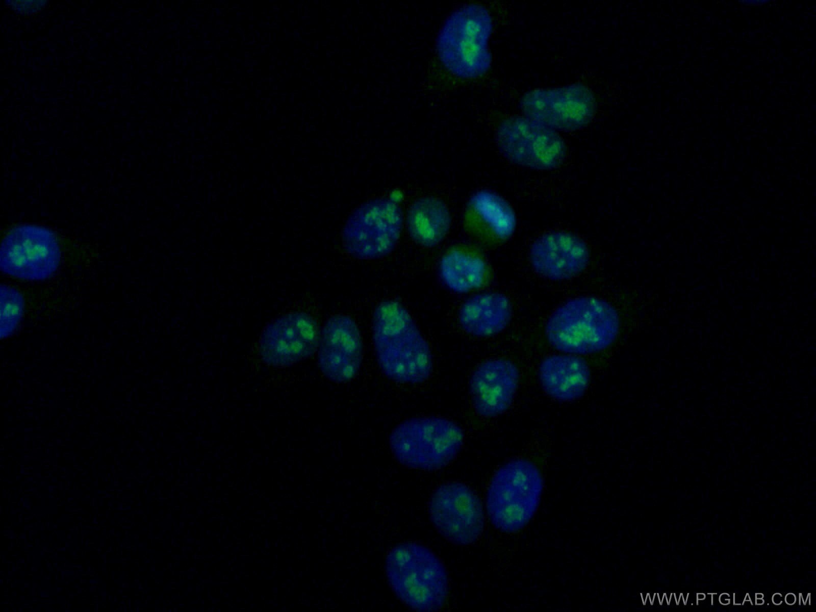 Immunofluorescence (IF) / fluorescent staining of HepG2 cells using DDX21 Monoclonal antibody (66925-1-Ig)