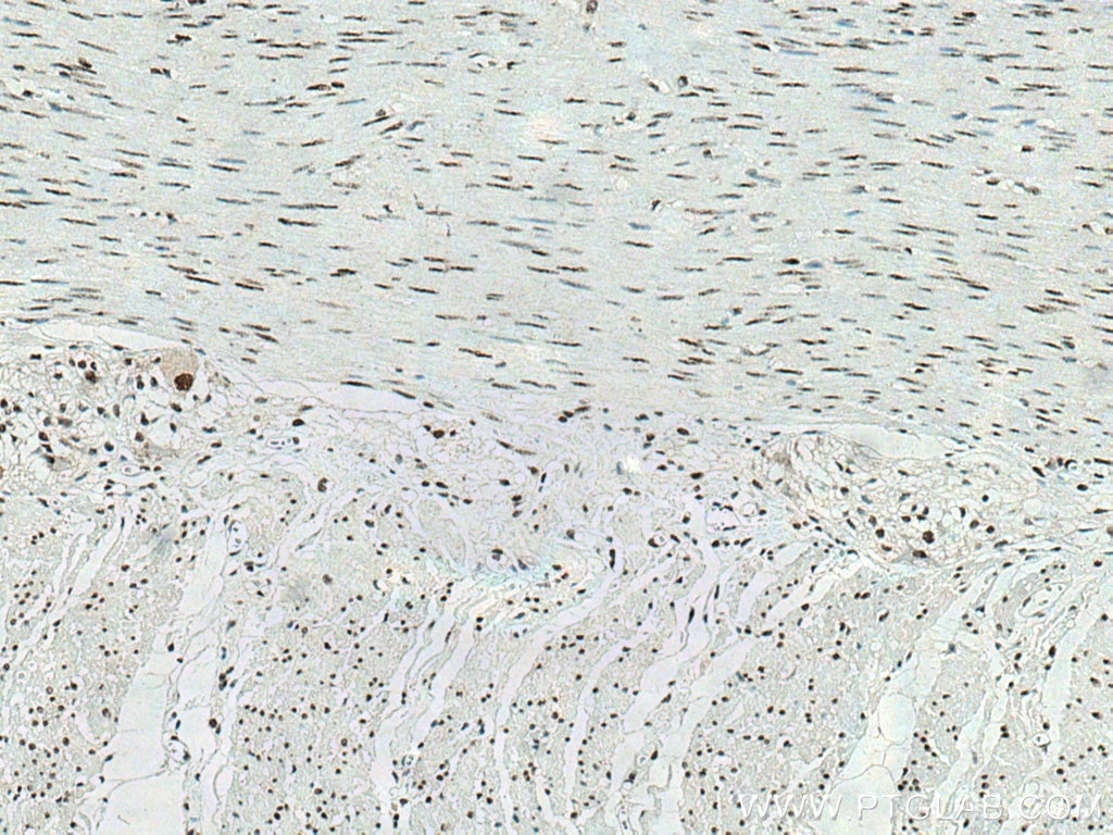 Immunohistochemistry (IHC) staining of human colon tissue using DDX21 Monoclonal antibody (66925-1-Ig)