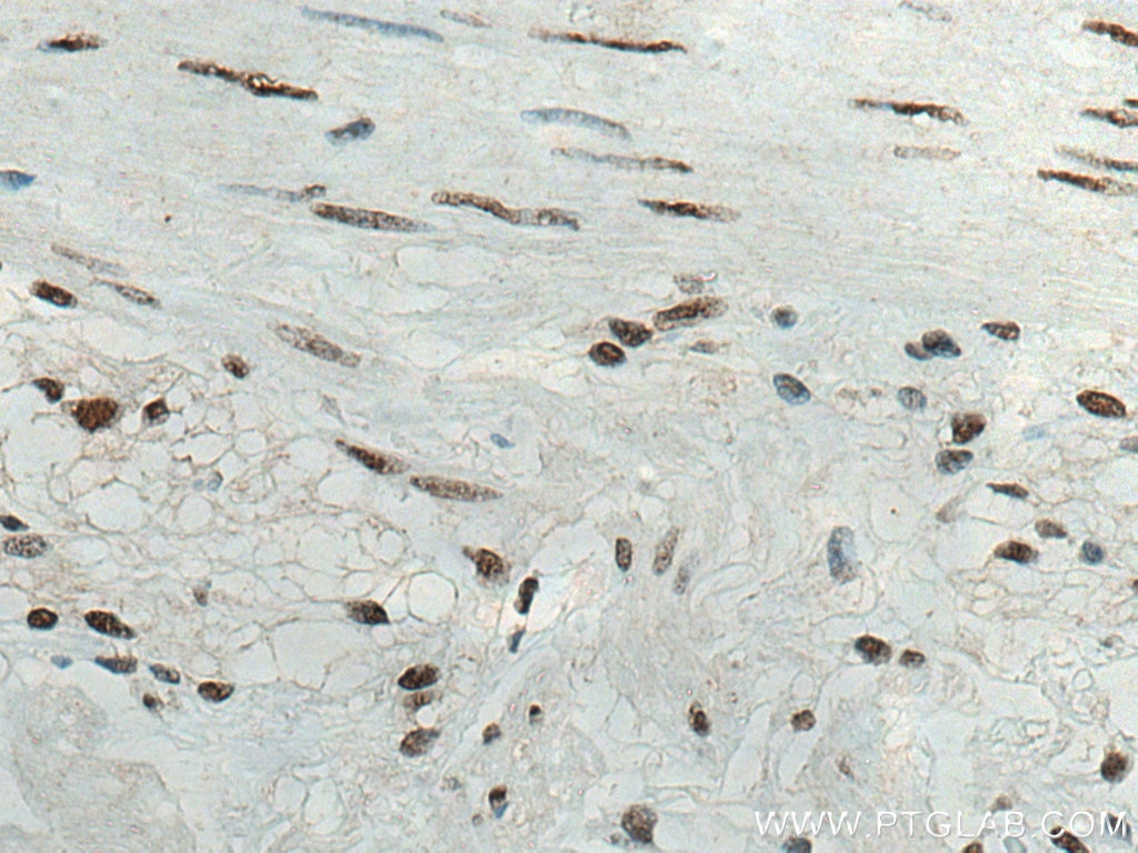 Immunohistochemistry (IHC) staining of human colon tissue using DDX21 Monoclonal antibody (66925-1-Ig)