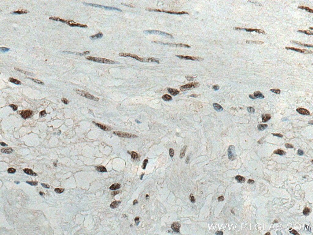 IHC staining of human colon using 66925-1-Ig