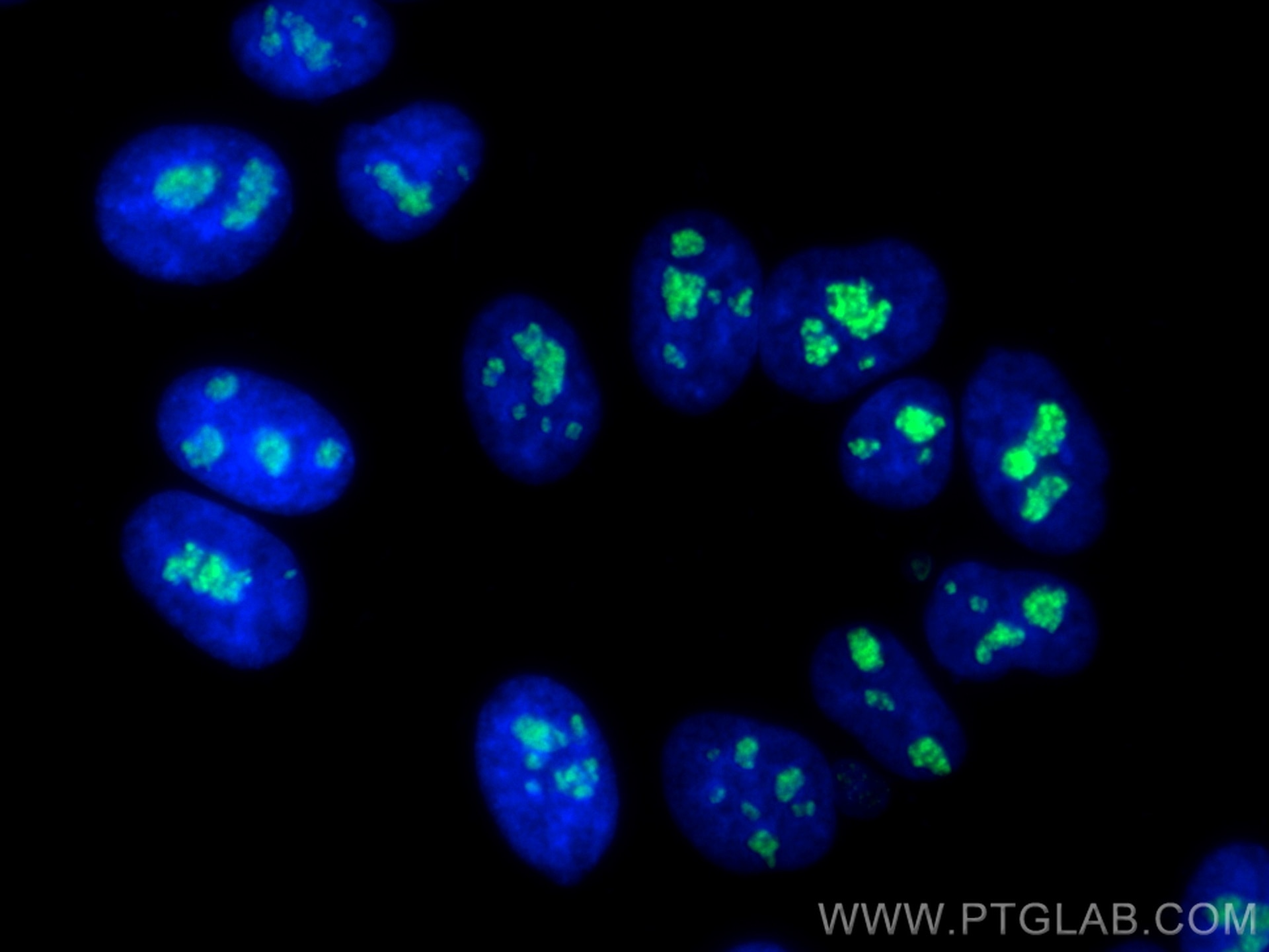 Immunofluorescence (IF) / fluorescent staining of HepG2 cells using DDX21 Recombinant antibody (80932-1-RR)