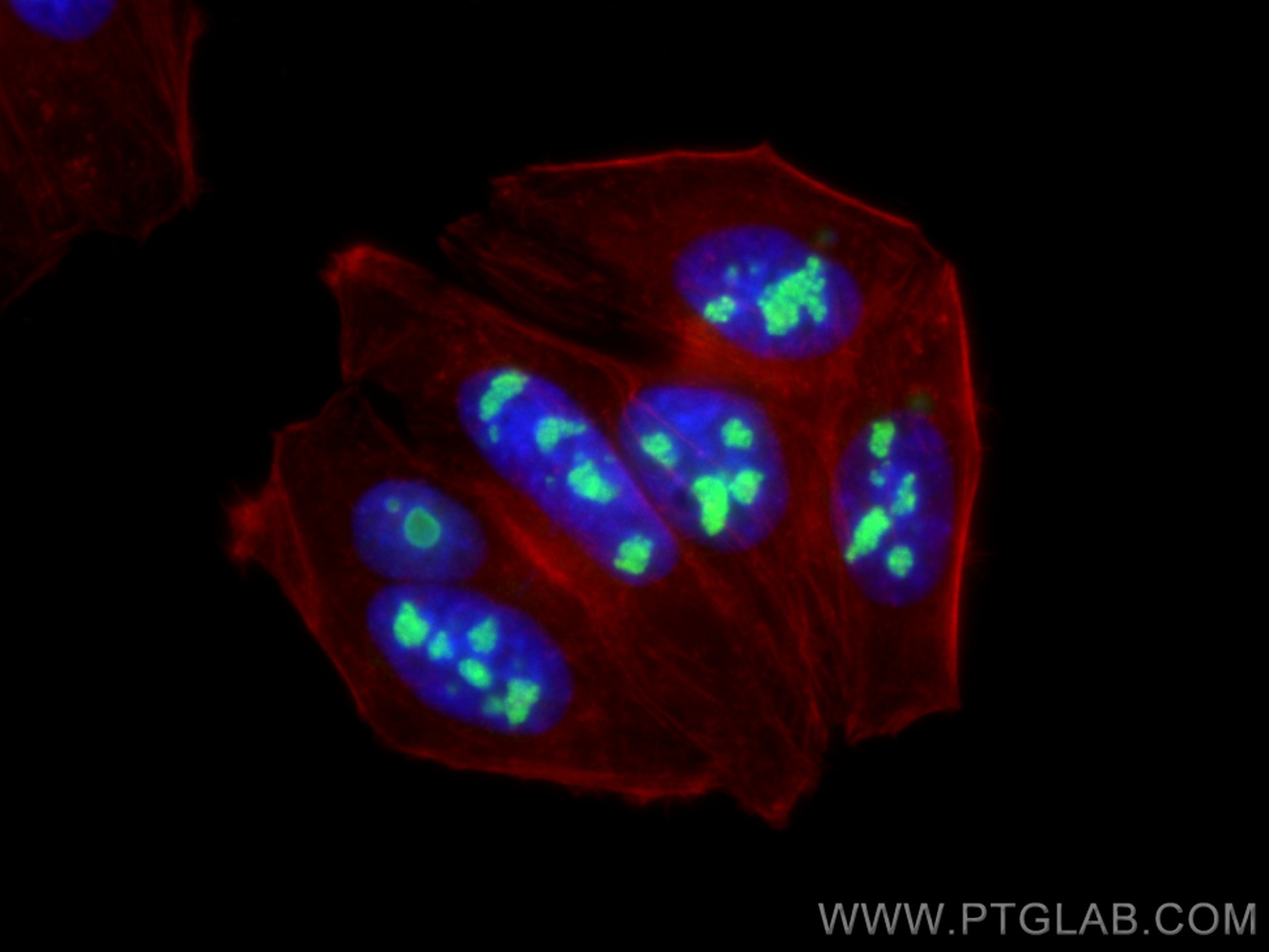 Immunofluorescence (IF) / fluorescent staining of HepG2 cells using DDX21 Recombinant antibody (80932-1-RR)