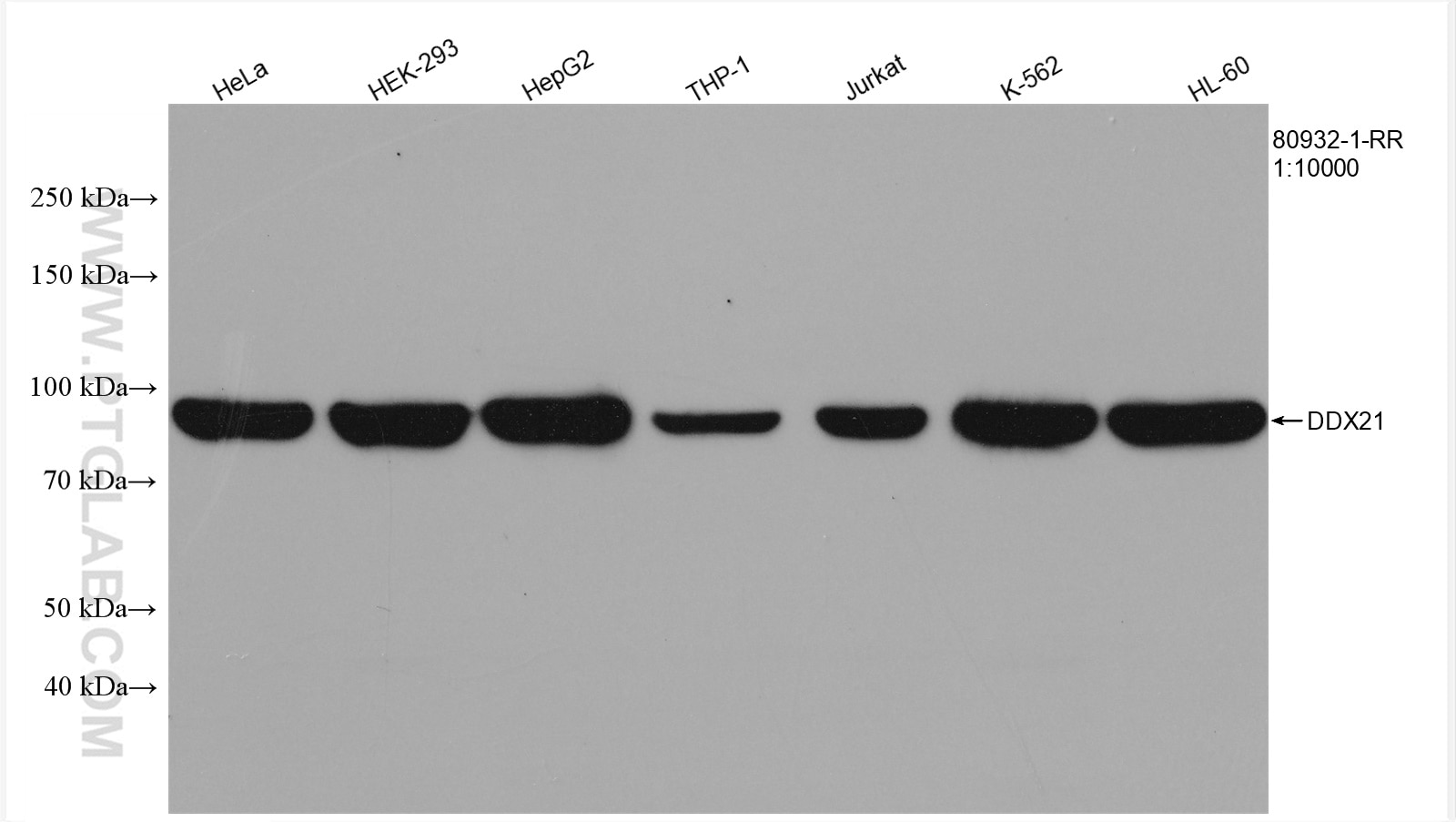Western Blot (WB) analysis of various lysates using DDX21 Recombinant antibody (80932-1-RR)