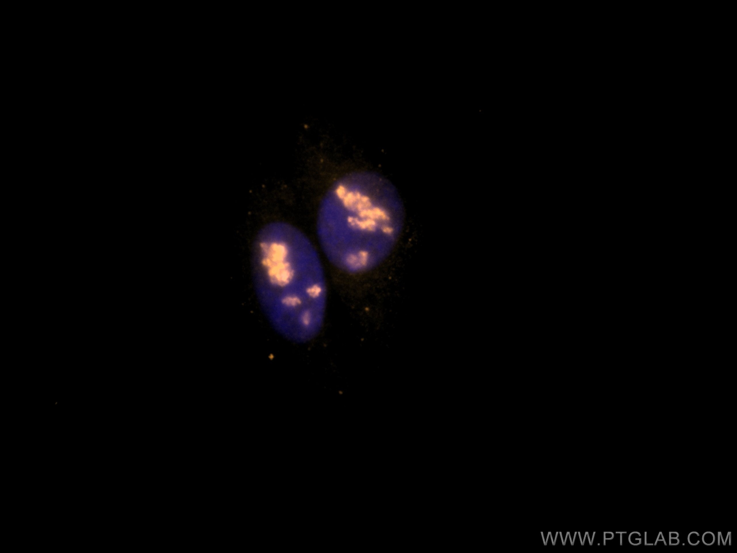 Immunofluorescence (IF) / fluorescent staining of HepG2 cells using CoraLite®555-conjugated DDX21 Monoclonal antibody (CL555-66925)