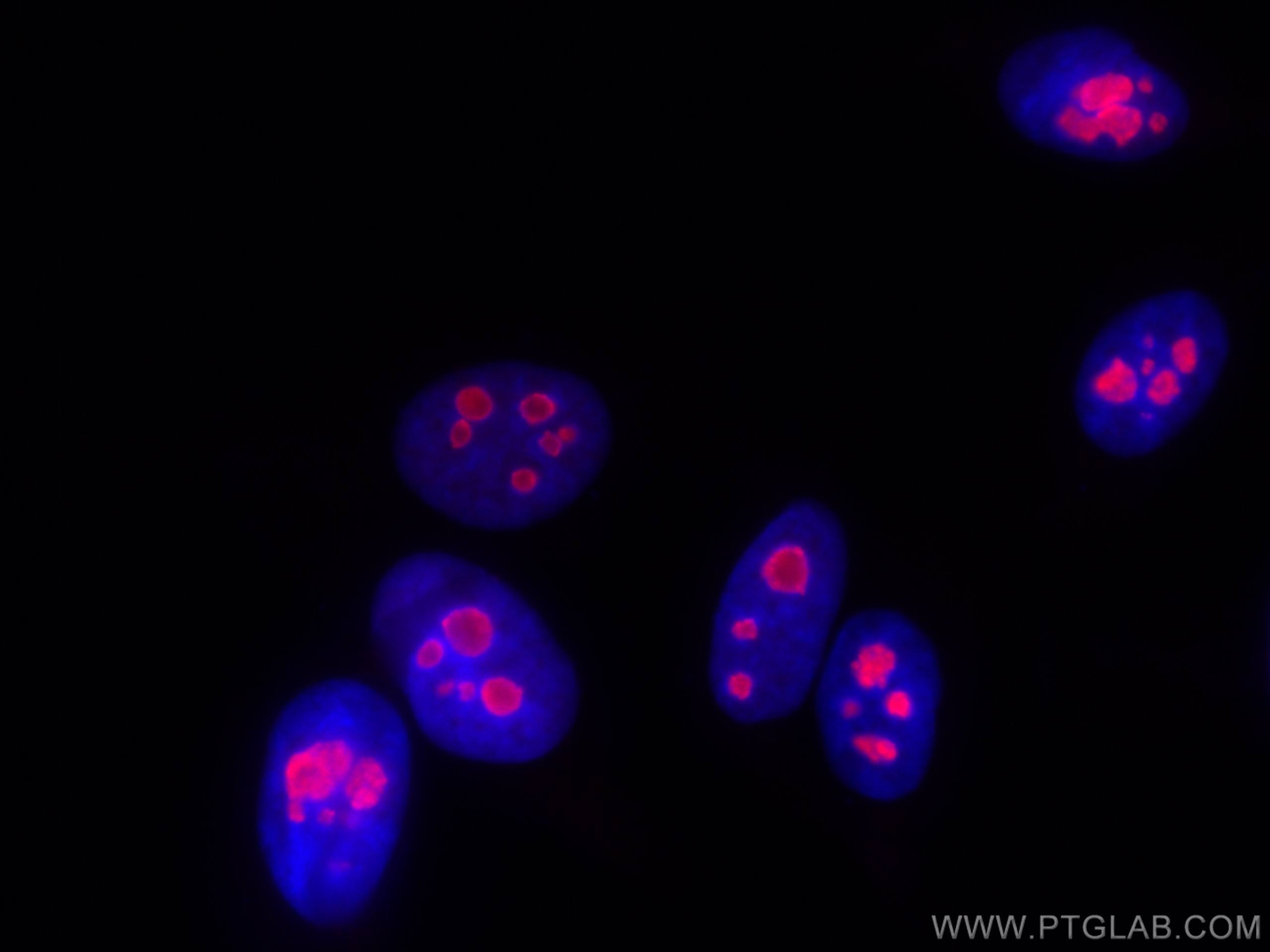 Immunofluorescence (IF) / fluorescent staining of HepG2 cells using CoraLite®594-conjugated DDX21 Polyclonal antibody (CL594-10528)
