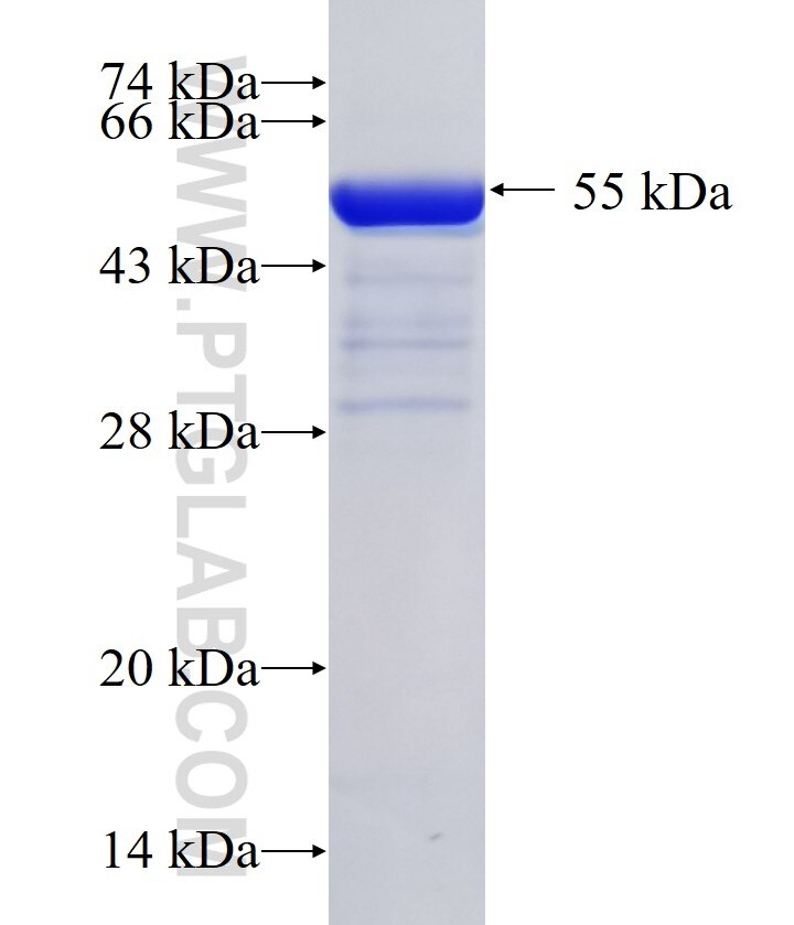 DDX21 fusion protein Ag0804 SDS-PAGE