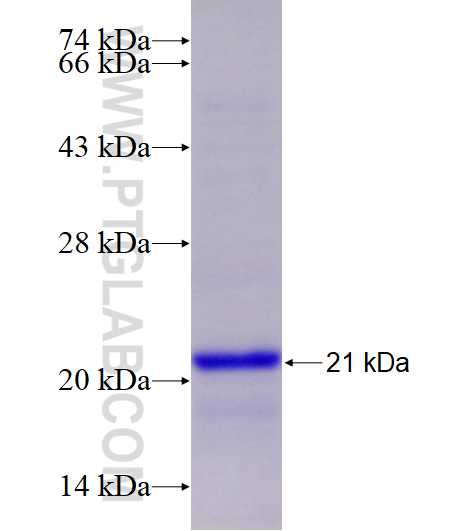 DDX21 fusion protein Ag17850 SDS-PAGE