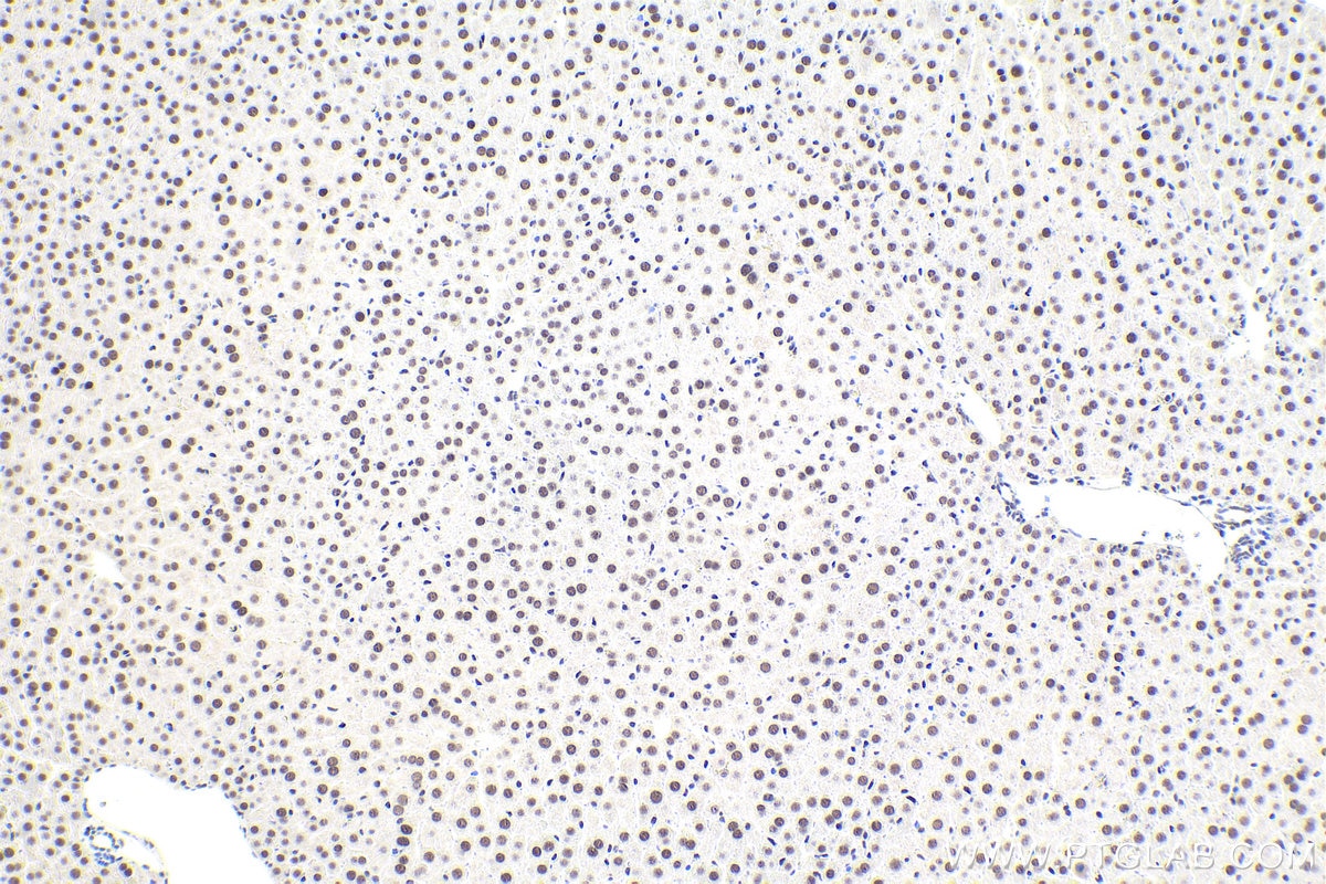 Immunohistochemistry (IHC) staining of mouse liver tissue using DDX23 Polyclonal antibody (10199-2-AP)