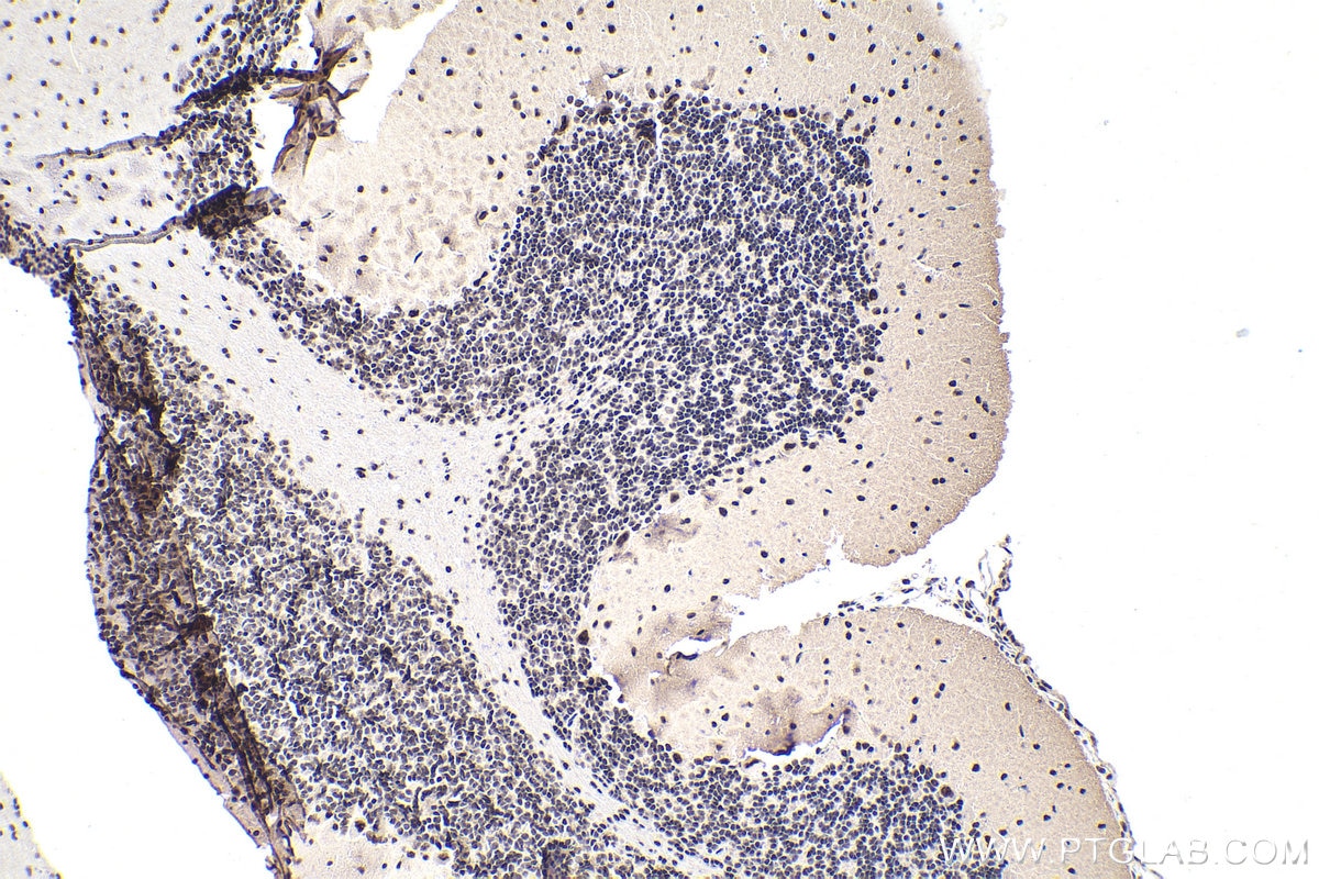 Immunohistochemistry (IHC) staining of rat cerebellum tissue using DDX23 Polyclonal antibody (10199-2-AP)