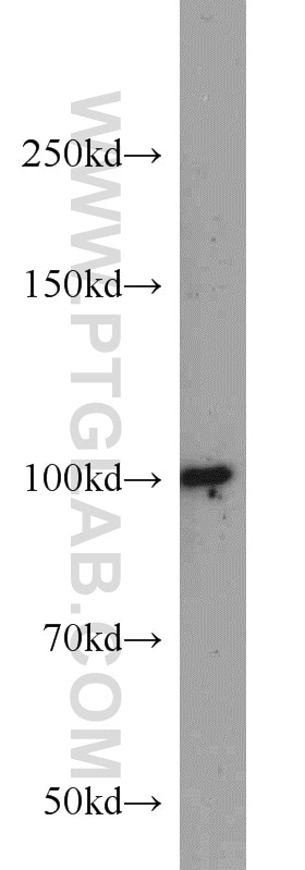 Western Blot (WB) analysis of K-562 cells using DDX23 Polyclonal antibody (10199-2-AP)