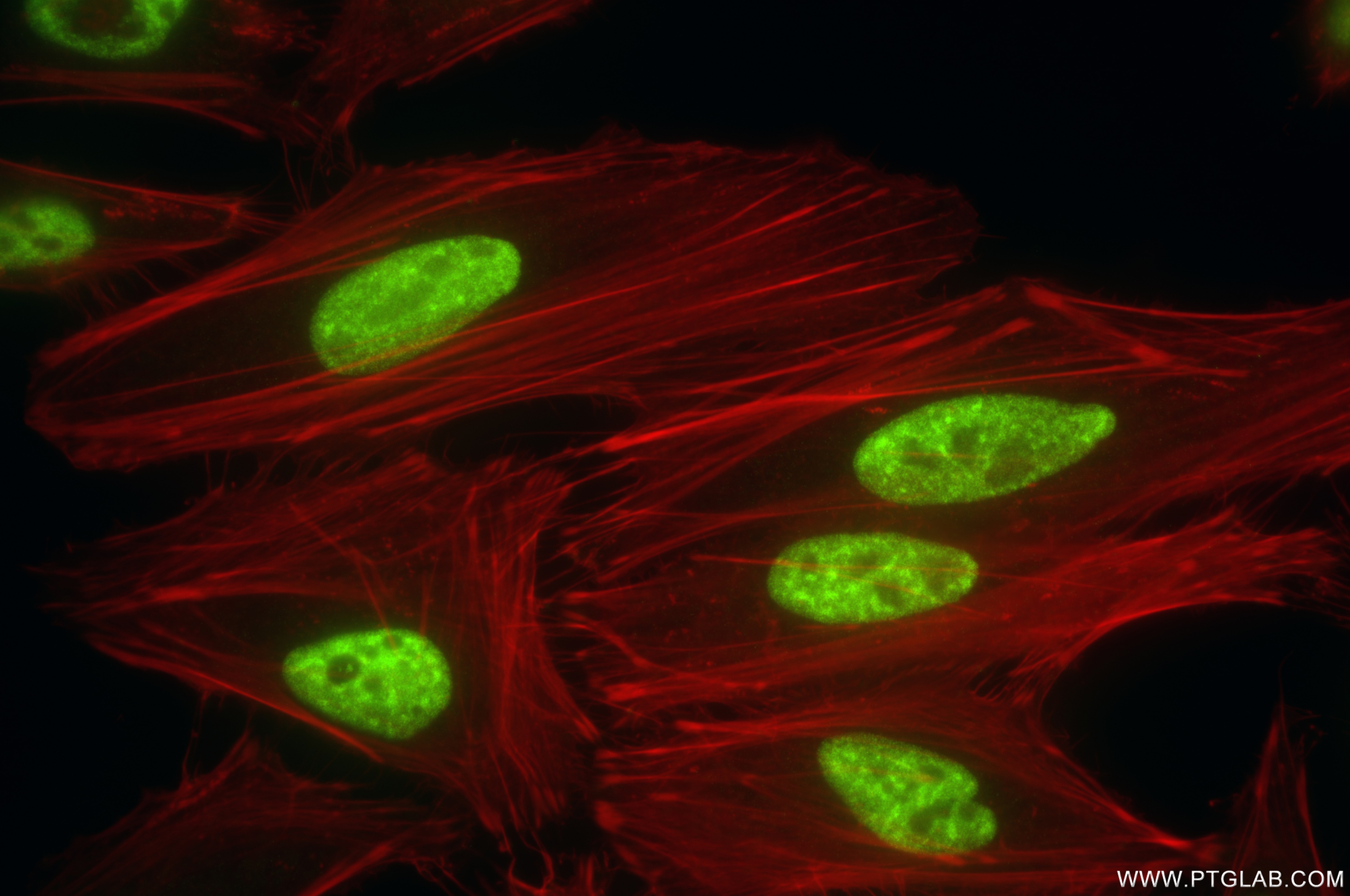 Immunofluorescence (IF) / fluorescent staining of HeLa cells using DDX23 Recombinant antibody (85763-4-RR)