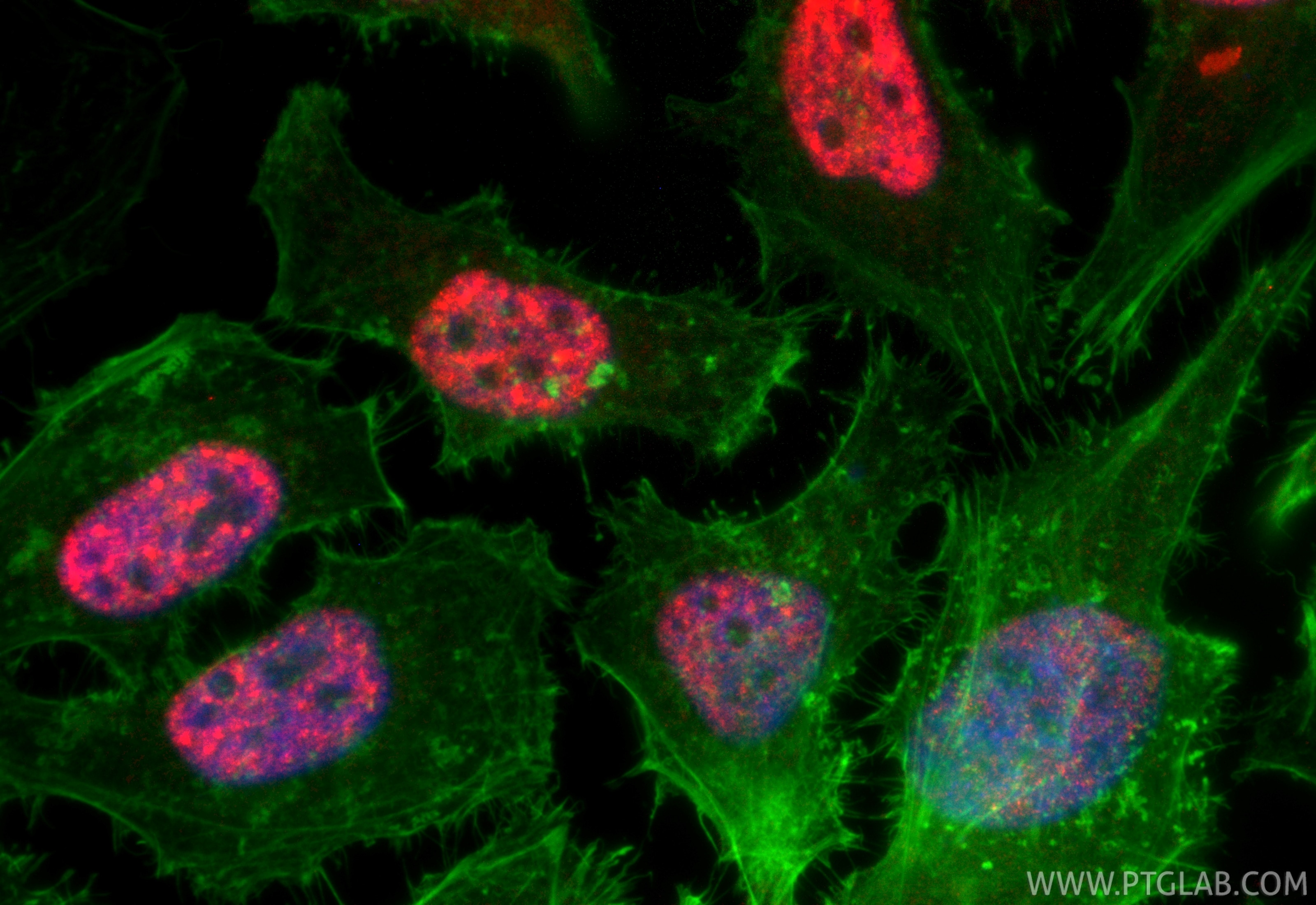 Immunofluorescence (IF) / fluorescent staining of HeLa cells using CoraLite®594-conjugated DDX23 Recombinant antibody (CL594-85763-4)