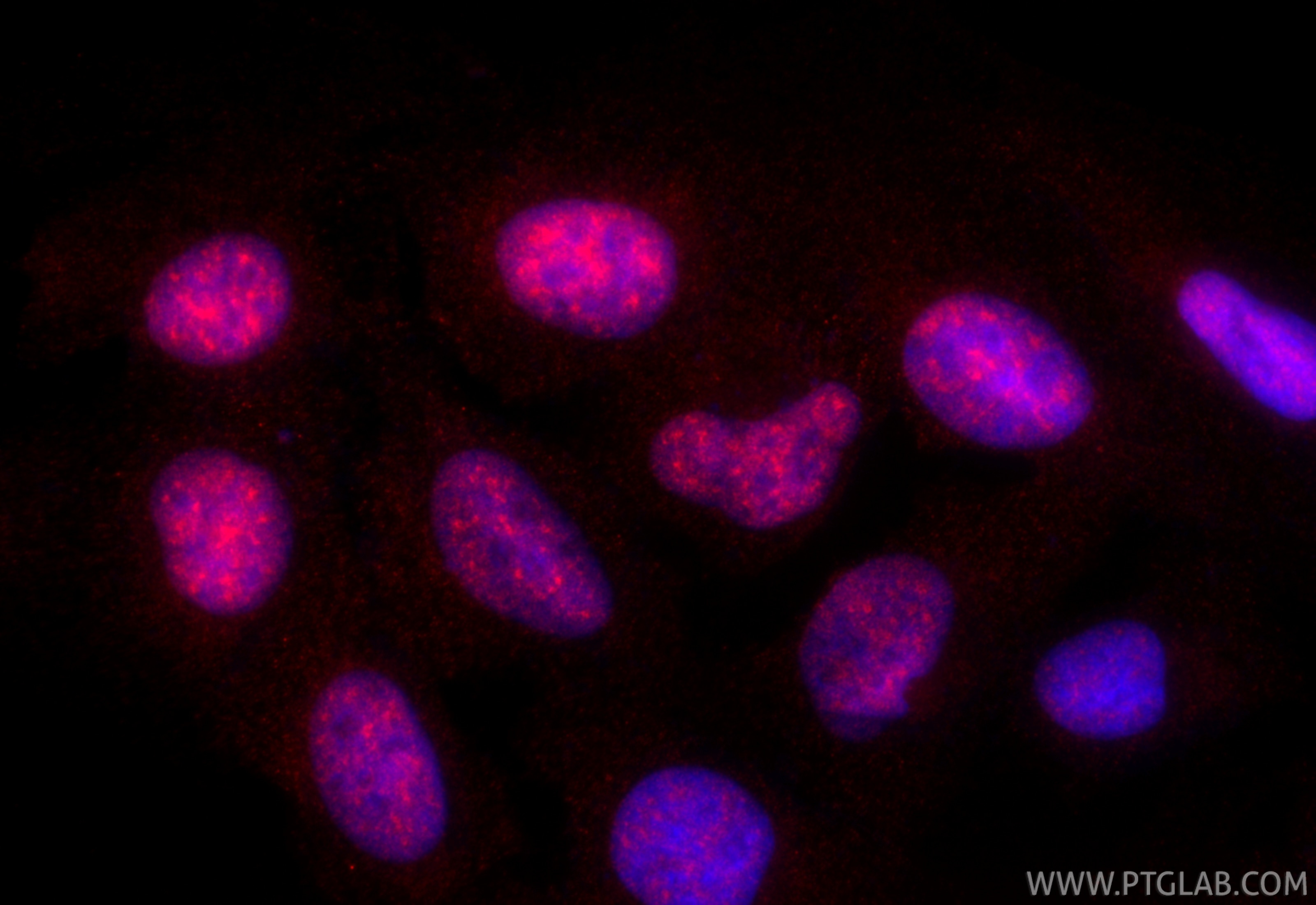 Immunofluorescence (IF) / fluorescent staining of U2OS cells using CoraLite®594-conjugated DDX23 Recombinant antibody (CL594-85763-4)