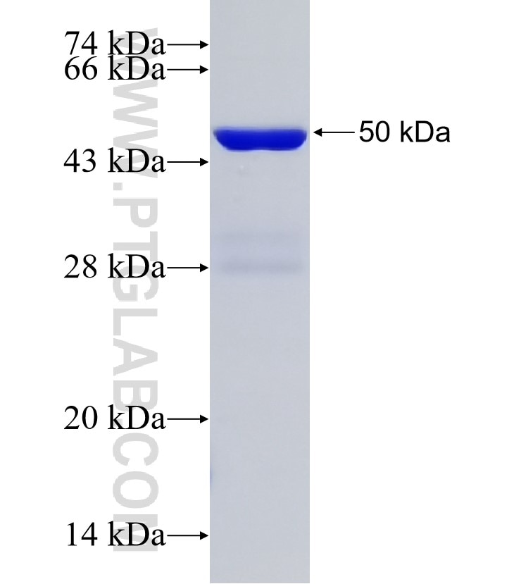 DDX23 fusion protein Ag0258 SDS-PAGE
