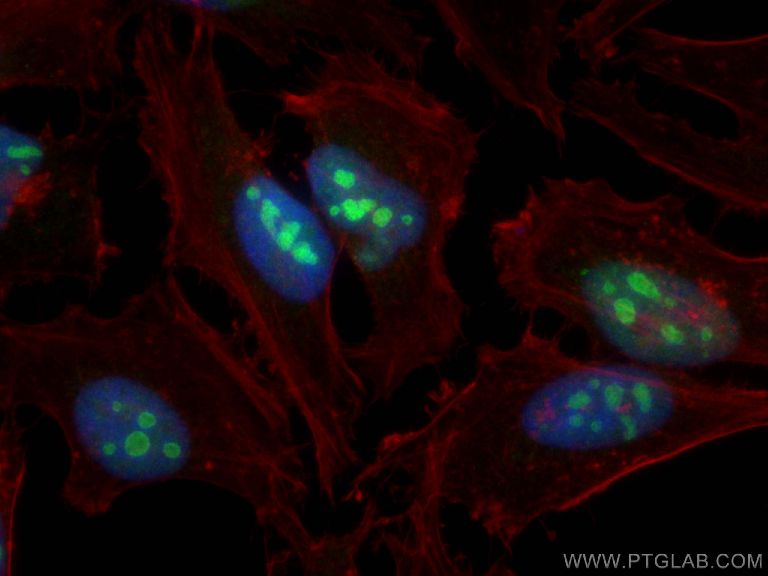 Immunofluorescence (IF) / fluorescent staining of HeLa cells using DDX24 Polyclonal antibody (15769-1-AP)