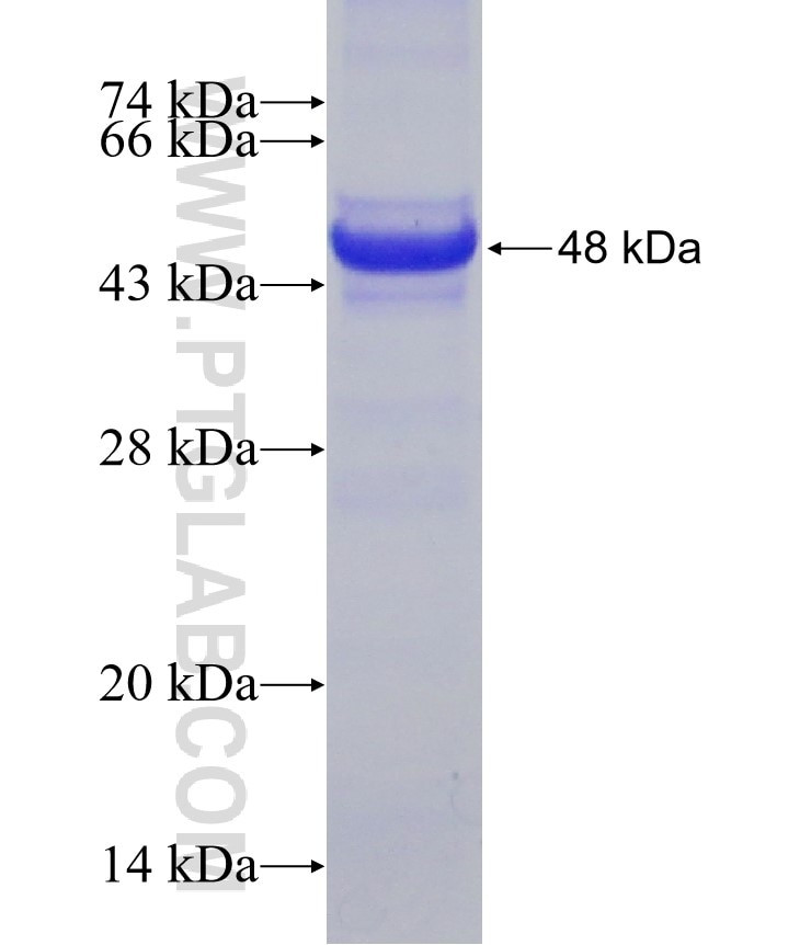 DDX24 fusion protein Ag8417 SDS-PAGE