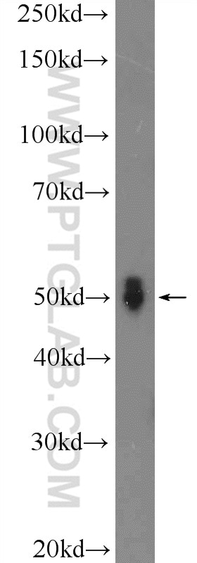 Western Blot (WB) analysis of Jurkat cells using DDX25 Polyclonal antibody (14370-1-AP)