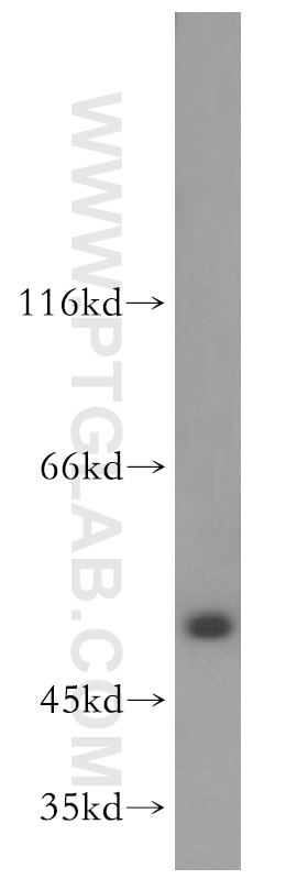 Western Blot (WB) analysis of human testis tissue using DDX25 Polyclonal antibody (14370-1-AP)