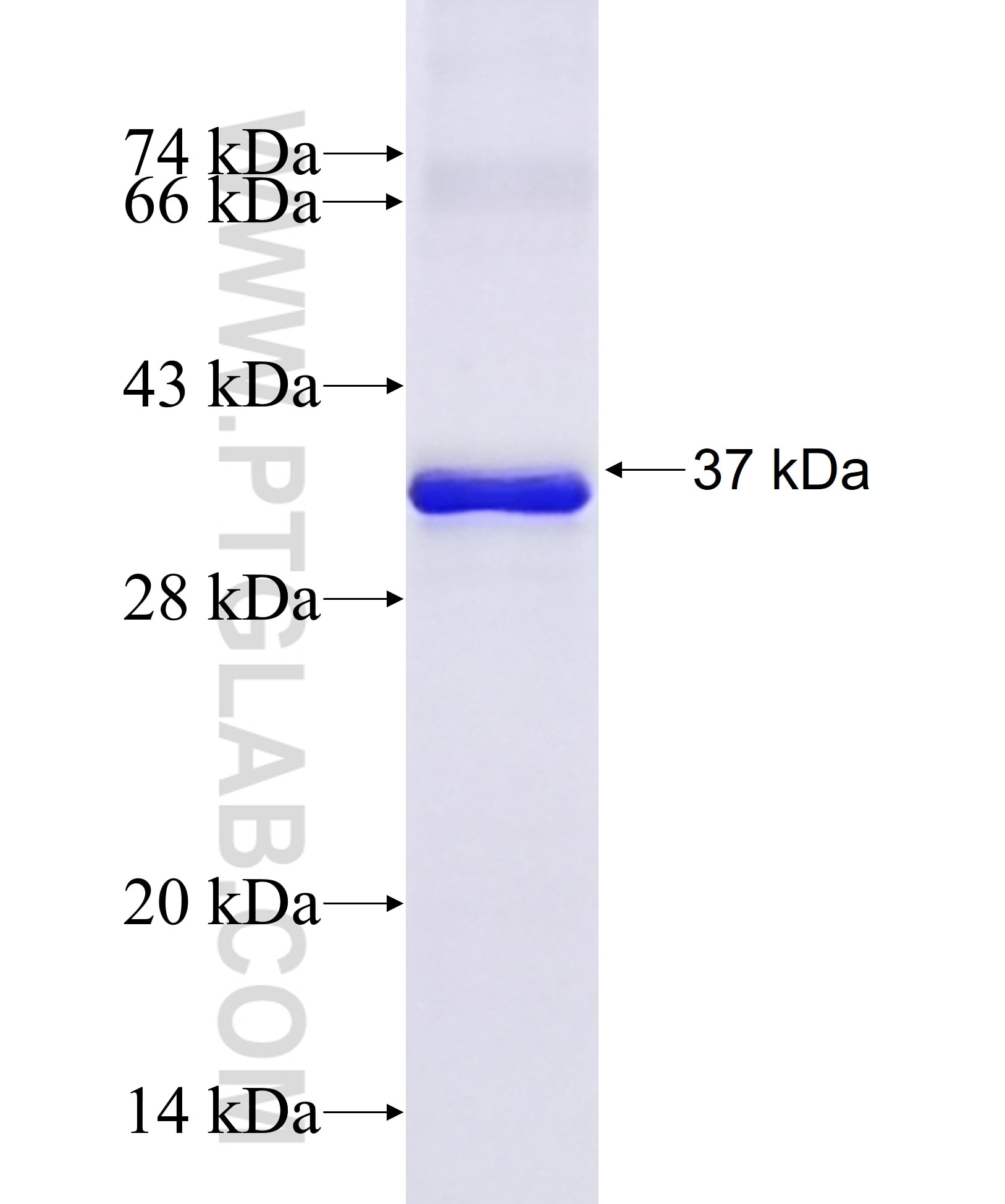 DDX26B fusion protein Ag37016 SDS-PAGE DDX26B fusion protein Ag37016 SDS-PAGE