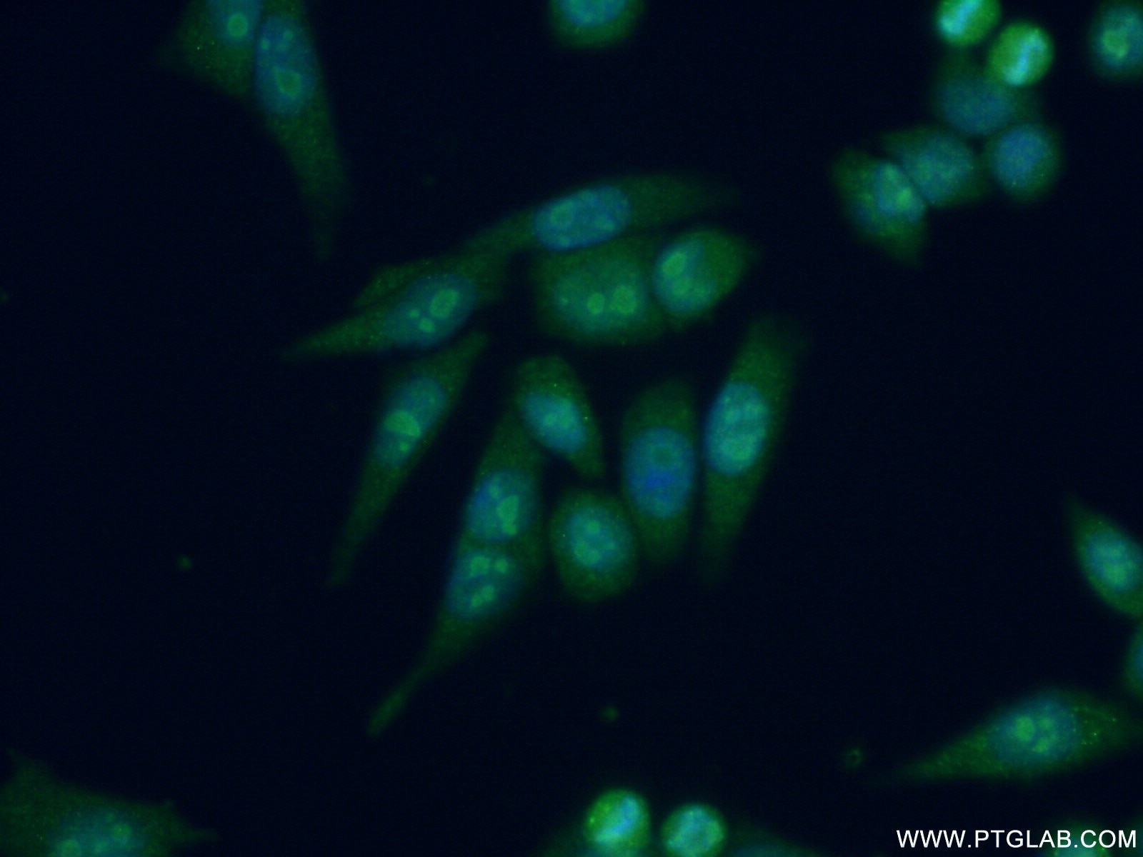 Immunofluorescence (IF) / fluorescent staining of HeLa cells using DDX27 Polyclonal antibody (17087-1-AP)