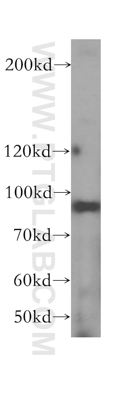 Western Blot (WB) analysis of HeLa cells using DDX27 Polyclonal antibody (17087-1-AP)