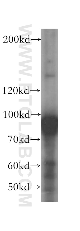 Western Blot (WB) analysis of mouse liver tissue using DDX27 Polyclonal antibody (17087-1-AP)