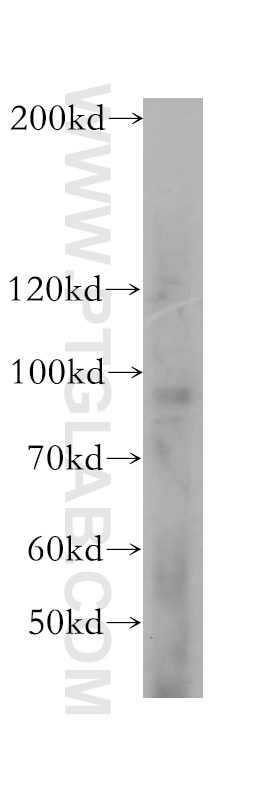 Western Blot (WB) analysis of NIH/3T3 cells using DDX27 Polyclonal antibody (17087-1-AP)