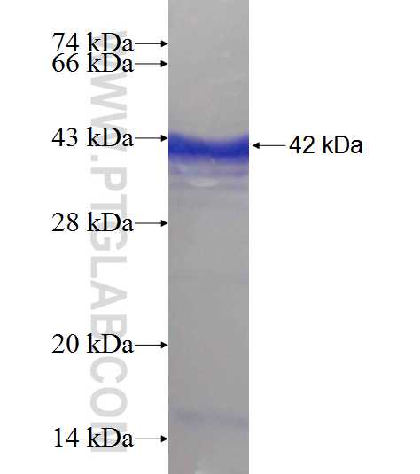 DDX27 fusion protein Ag9426 SDS-PAGE