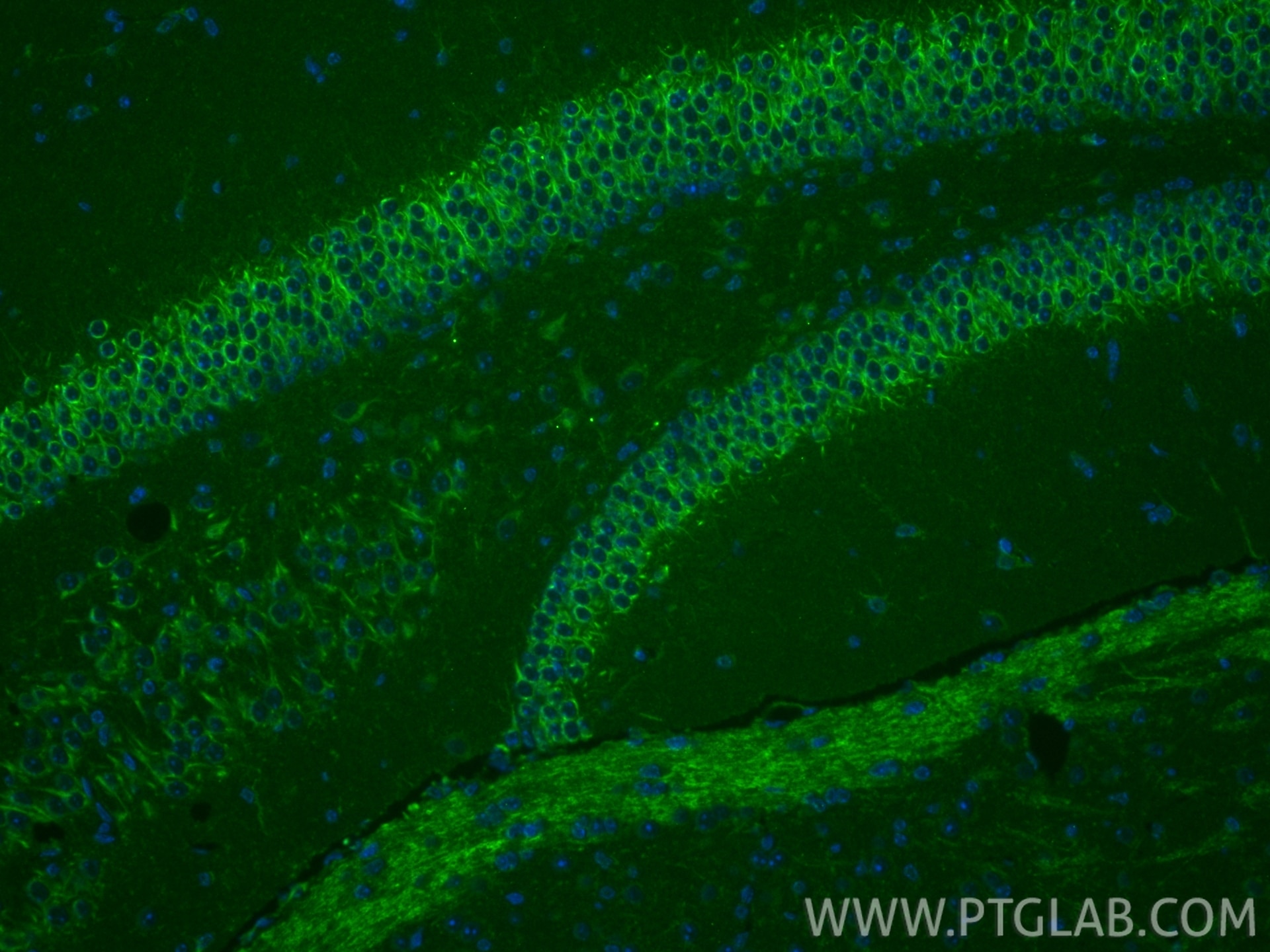 Immunofluorescence (IF) / fluorescent staining of mouse brain tissue using DDX28 Polyclonal antibody (11617-1-AP)