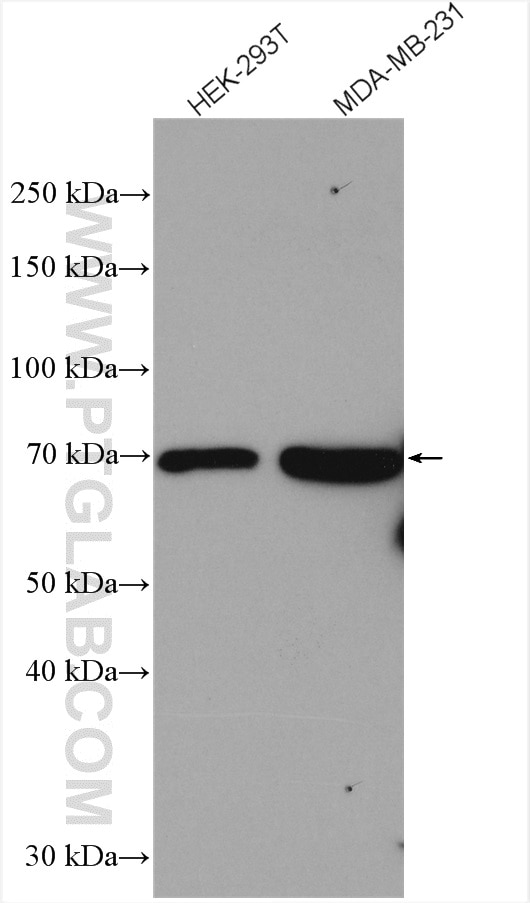 Western Blot (WB) analysis of various lysates using DDX28 Polyclonal antibody (11617-1-AP)
