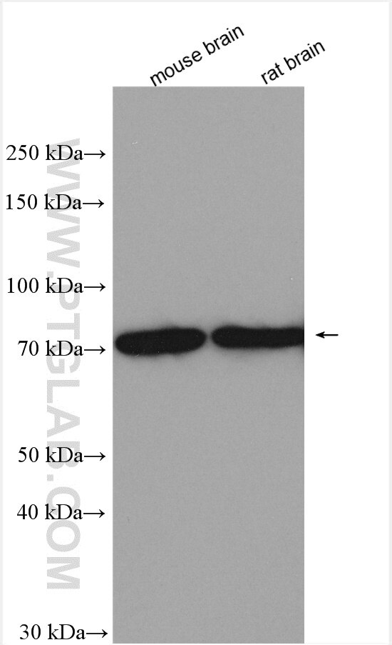 Western Blot (WB) analysis of various lysates using DDX3 Polyclonal antibody (11115-1-AP)