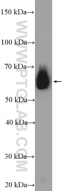 Western Blot (WB) analysis of mouse liver tissue using DDX3 Polyclonal antibody (11115-1-AP)