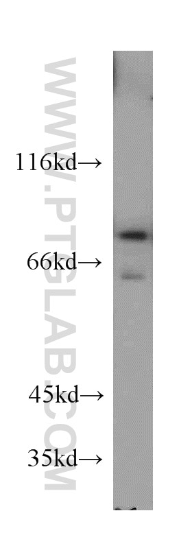 Western Blot (WB) analysis of NIH/3T3 cells using DDX3 Polyclonal antibody (11115-1-AP)