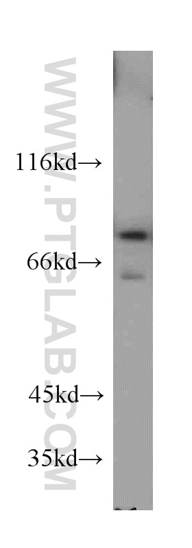 WB analysis of NIH/3T3 using 11115-1-AP