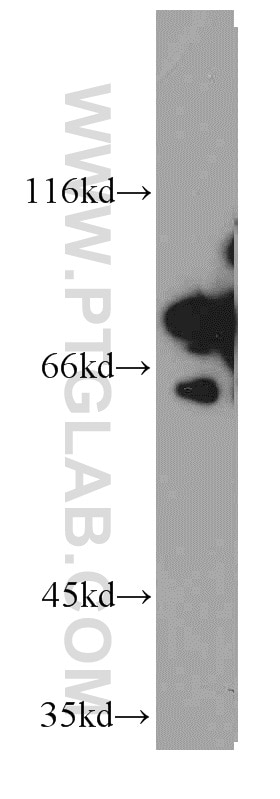 Western Blot (WB) analysis of HT-1080 cells using DDX3 Polyclonal antibody (11115-1-AP)